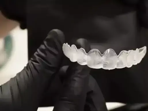 Zirconia veneers — Before