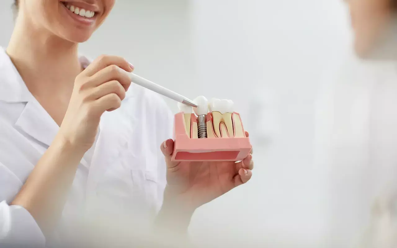 Dental Implants: How Long They Last