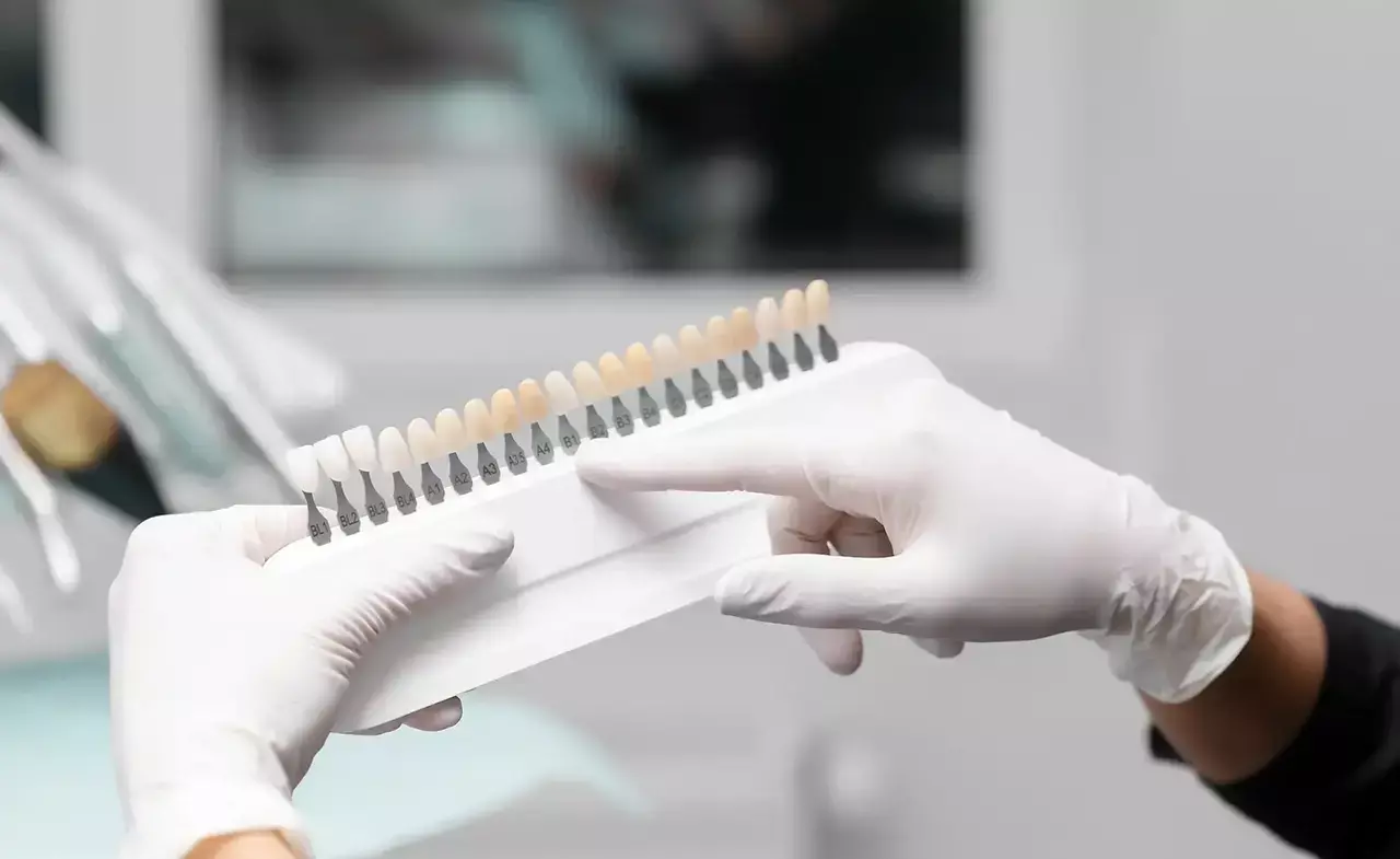 Are Dental Veneers Right for You? Candidacy Explained (2026)