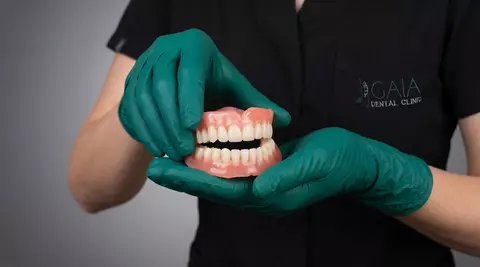 Implants vs Prosthetics: Which Is Right