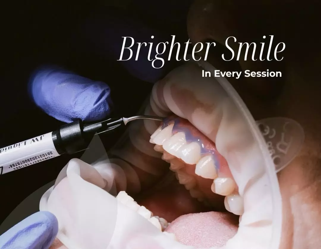 Is Teeth Whitening Safe? Sensitivity, Enamel & Who Should Avoid It (2026)