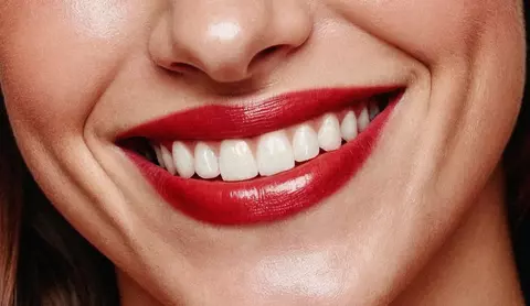 Hollywood Smile Aftercare: Care and How Long It Lasts (2026)