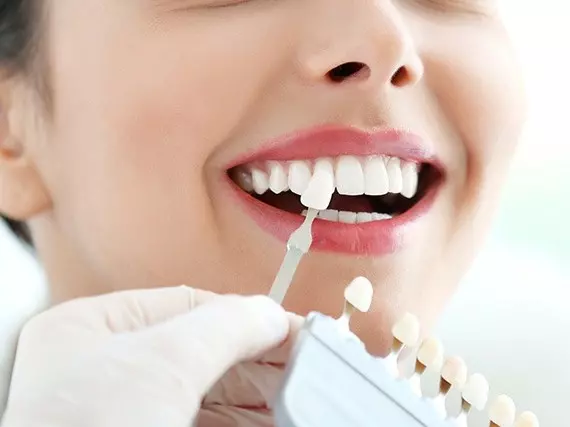 Teeth Whitening in Tirana: Professional vs At-Home Options (2026)