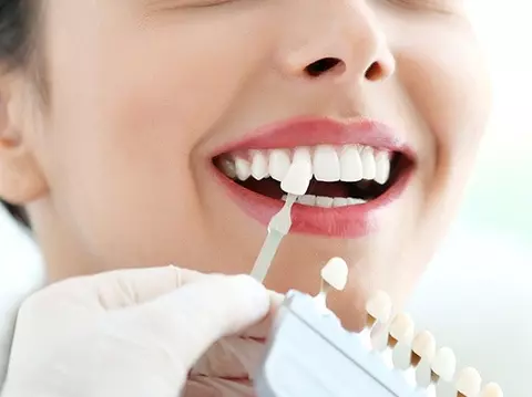 Teeth Whitening in Tirana: Professional vs At-Home Options (2026)