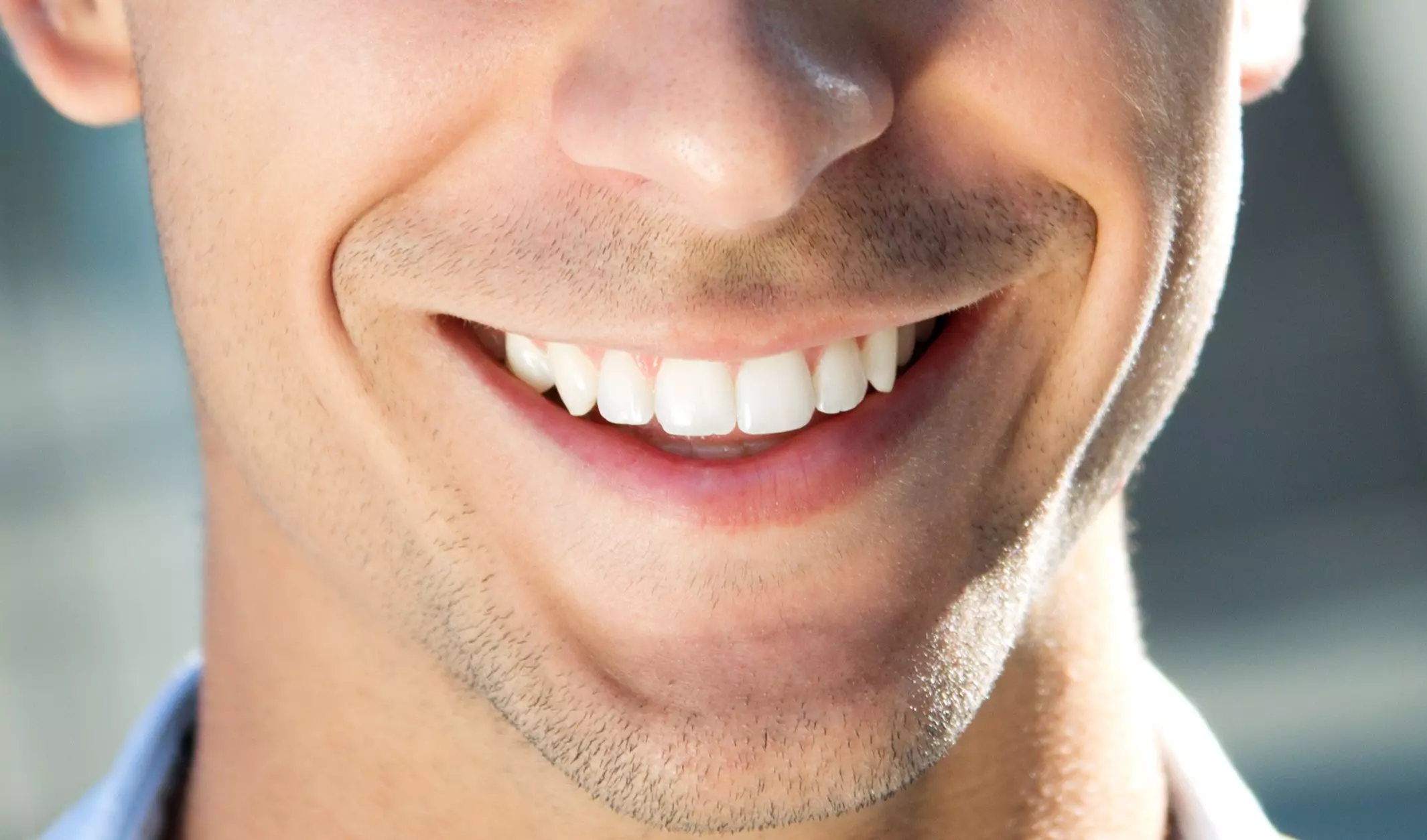 How Long Does Teeth Whitening Last? Longevity & Maintenance (2026)